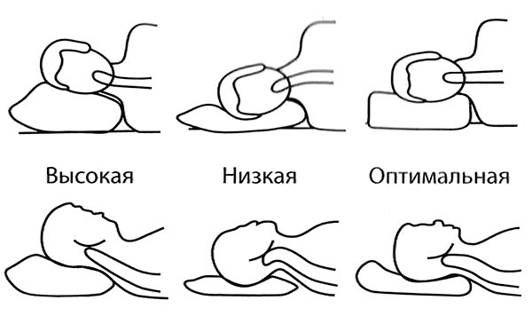 Ортопедическая подушка