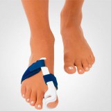 Вальгусная деформация первого пальца стопы. Hallux valgus