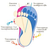 деформация-стоп